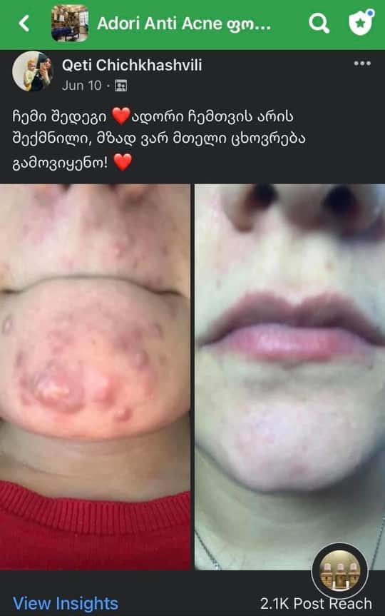 პაციენტის მკურნალობის შედეგი