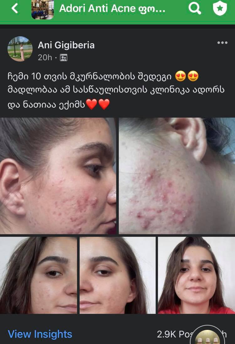 პაციენტის 10 თვის მკურნალობის შედეგი