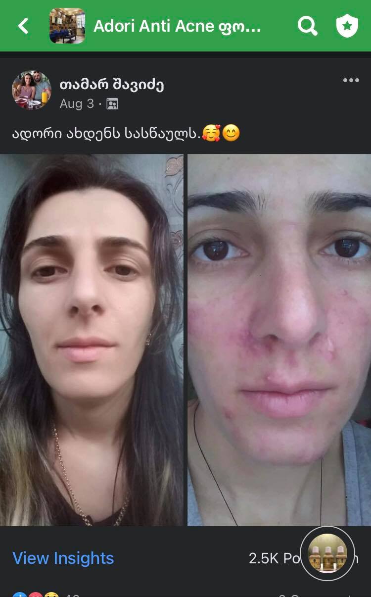 პაციენტის დასრულებული მკურნალობის შედეგი