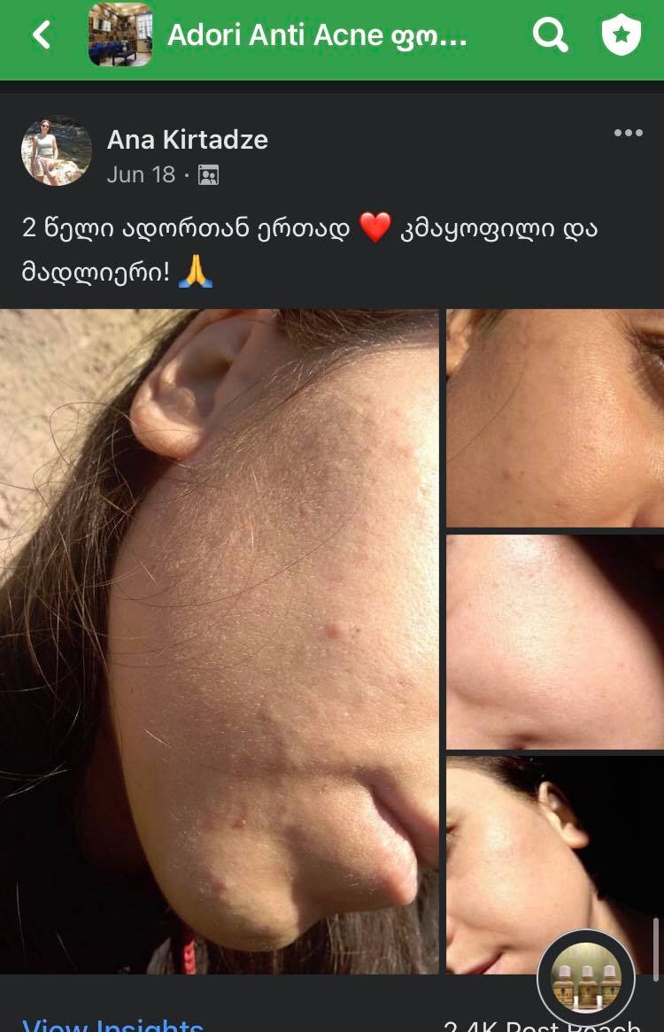 პაციენტის დასრულებული მკურნალობის შედეგი