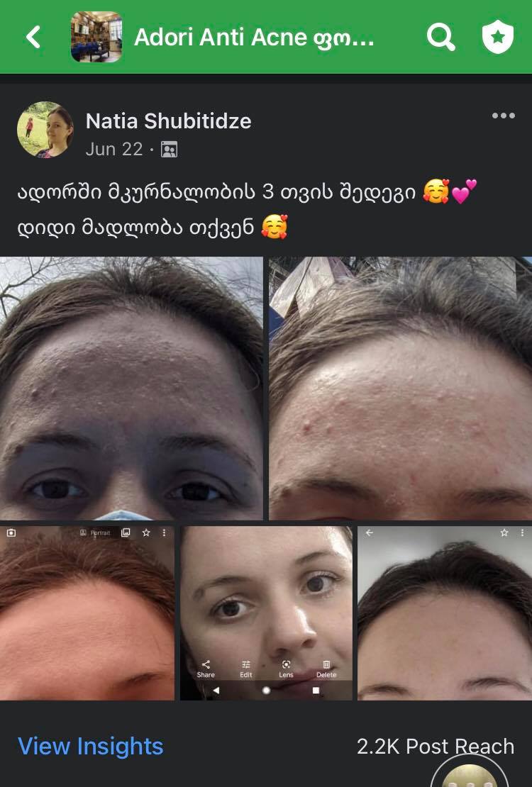 პაციენტის 3 თვის მკურნალობის შედეგი