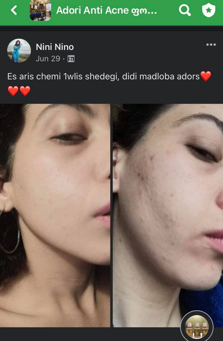 პაციენტის 12 თვის მკურნალობის შედეგი