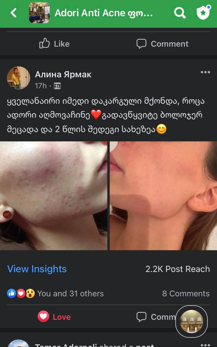 პაციენტის დასრულებული მკურნალობის შედეგი