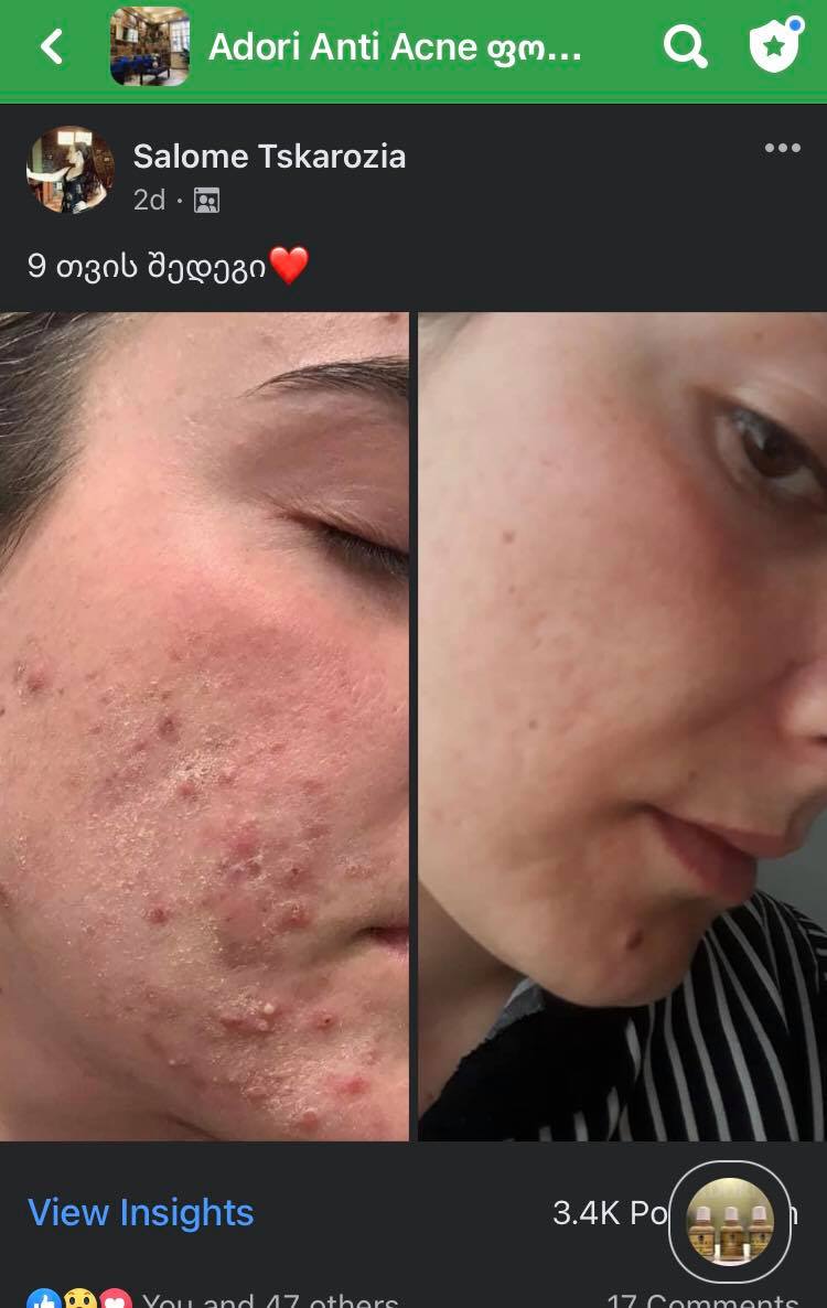 პაციენტის 9 თვის მკურნალობის შედეგი