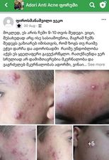 პაციენტის მკურნალობის 10 თვის შედეგი