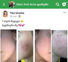 პაციენტის მკურნალობის 7 თვის შედეგი