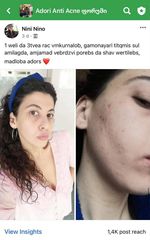 პაციენტის 15 თვის მკურნალობის შედეგი