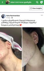 პაციენტის მკურნალობის 1 კვირის შედეგი