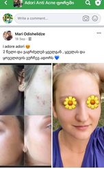 2 წლის მკურნალობის შედეგი