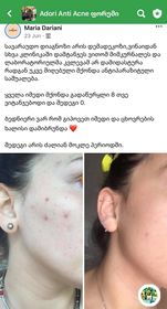 პაციენტის 1 თვის მკურნალობის შედეგი