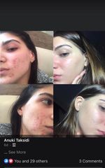 1,5 თვის მკურნალობის შედეგი