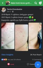 2 წლის მკურნალობის შედეგები