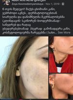 6 თვის მკურნალობის შედეგი