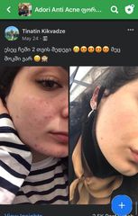 2 თვის მკურნალობის შედეგი