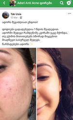 1 წლის მკურნალობის შედეგი