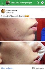 4 თვის შედეგი