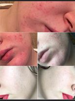 4 თვის შედეგი