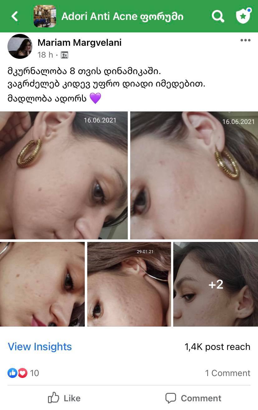 პაციენტის 8 თვის მკურნალობის შედეგი